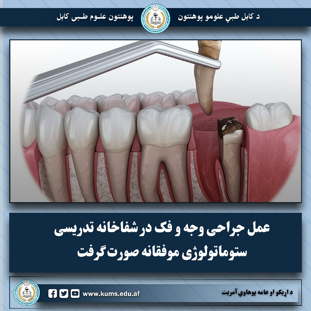 عمل جراحی وجه و فک در شفاخانه تدریسی ستوماتولوژی موفقانه صورت گرفت