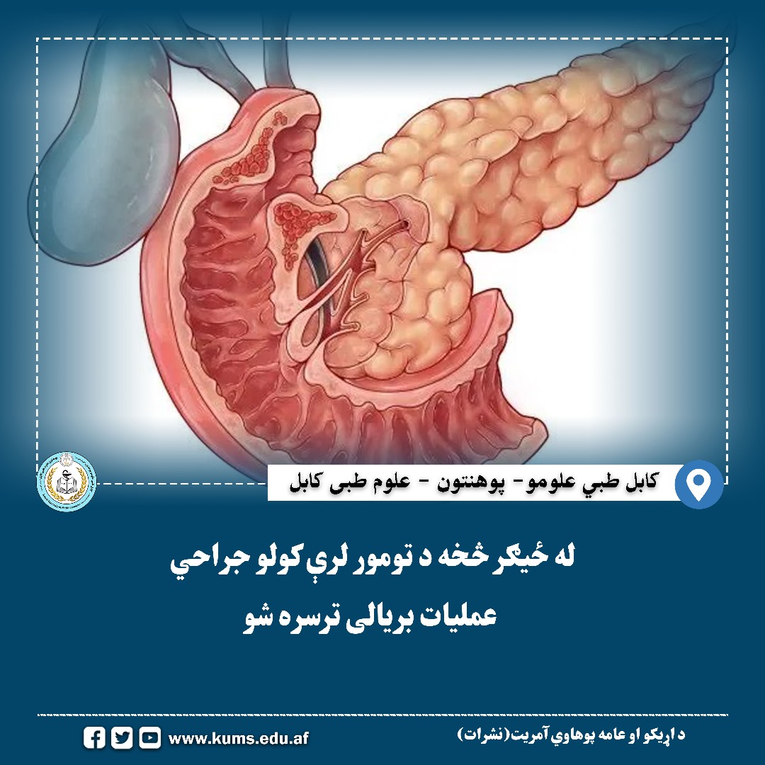 عمل جراحی برداشت تومور از جگر(کبد) موفقانه انجام شد