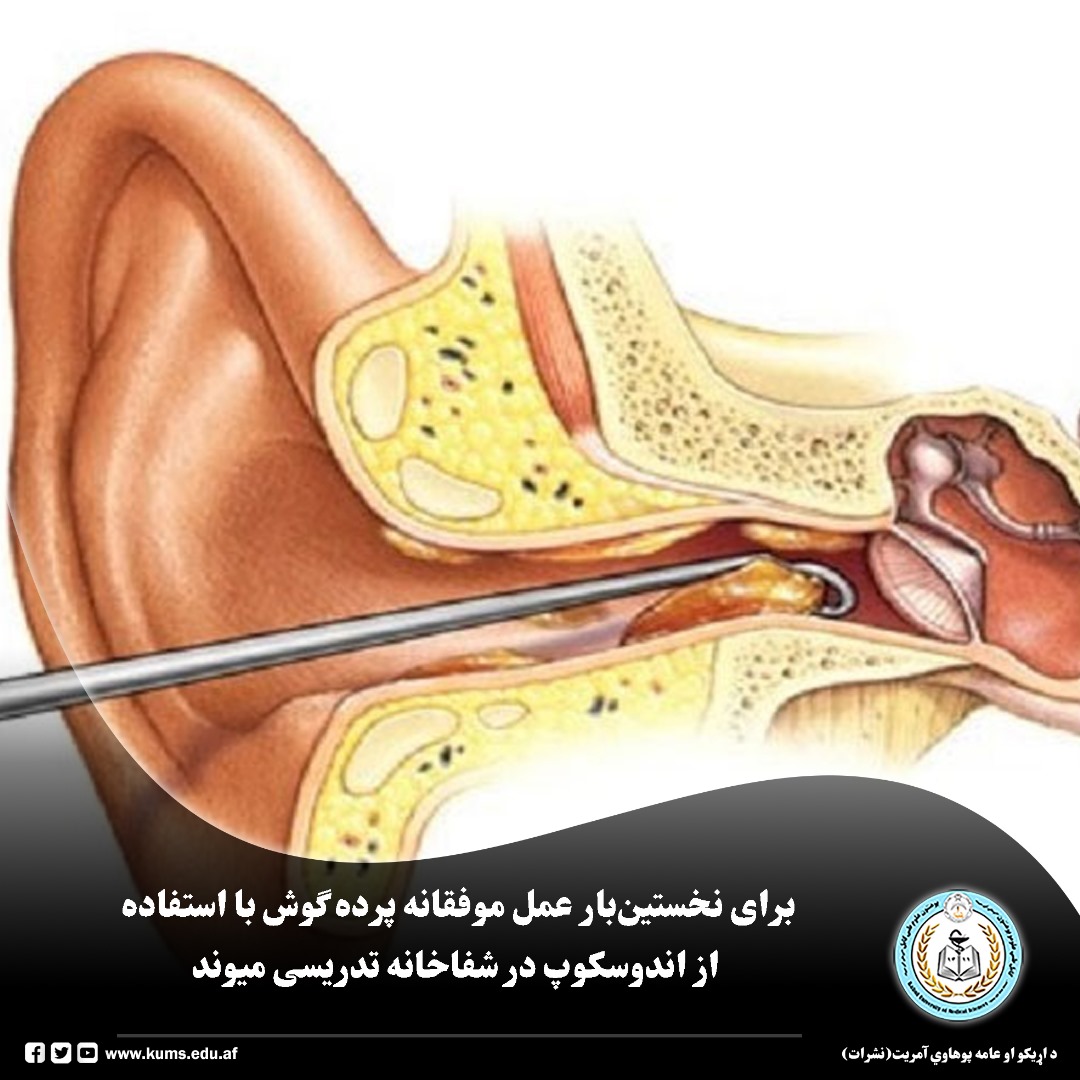 بر اساس گزارش شفاخانه تدریسی میوند برای نخستین‌بار به سطح شفاخانه های دولتی عمل جراحی پرده گوش (تیمپانوپلاستی) با استفاده از اندوسکوپ و روش‌های جدید و معیاری در این شفاخانه به گونه موفقانه انجام شد. 