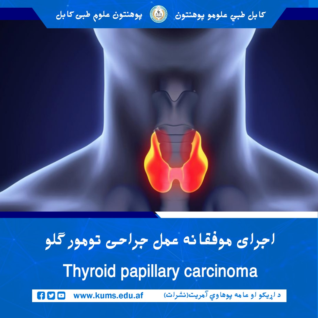 داکتران دیپارتنمت گوش، گلو و بینی شفاخانه تدریسی میوند پوهنتون علوم طبی کابل به همکاری داکتر حامد مشرقی از انجام موفقانه عمل جراحی تومور گلو یا thyroid papillary carcinoma خبر میدهد.