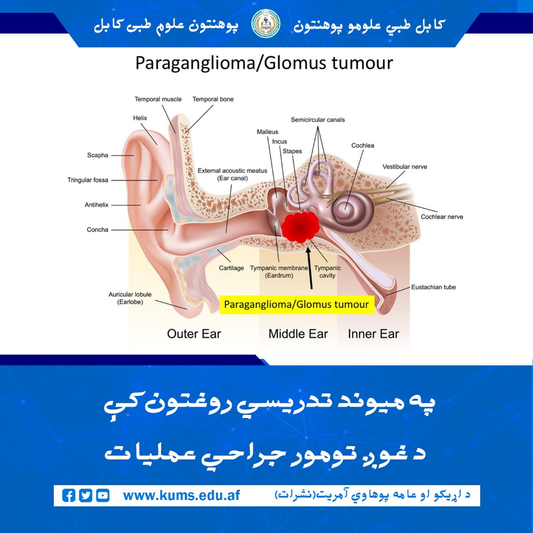 عمل جراحی موفقانه برداشتن تومور گوش در شفاخانه تدریسی میوند توسط تیم داکتران دیپارتمنت گوش، گلو و بینی انجام شد.